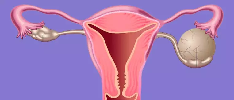 Perekrut Nizhky Kisty Yayechnyka 1