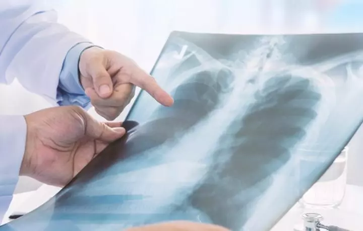 Rak Lekyh 4 Stadyya Lechenye